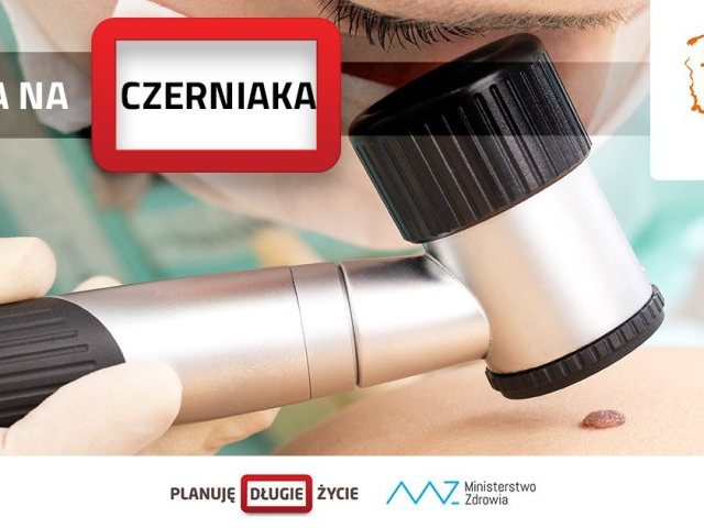 Uwaga na czerniaka - Planuj Długie Życie